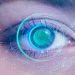 Why You Should Consider Laser Eye Surgery in London